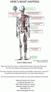 Symptoms of a postural misalignment.